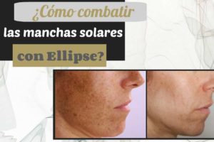 Manchas solares