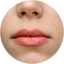 tratamientos estéticos piel peeling labial
