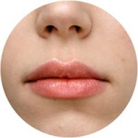 tratamientos estéticos piel peeling labial